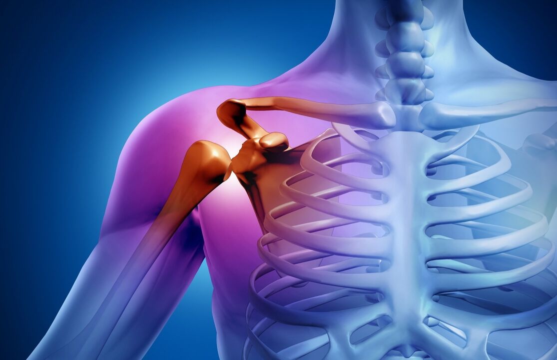 shoulder joint arthrosis
