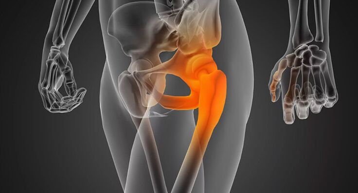 Infectious hip pain that requires antibiotic treatment