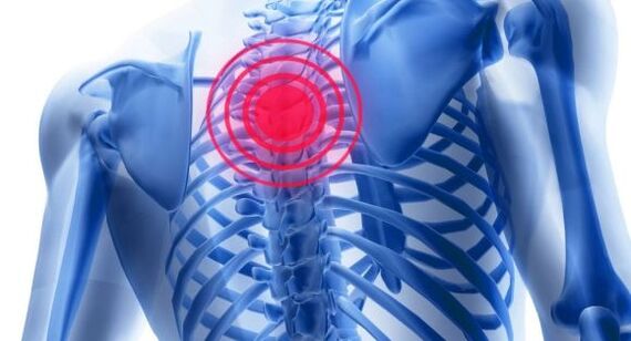 Treatment of osteochondrosis of the chest spine