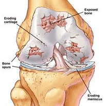 The mechanism of joint development